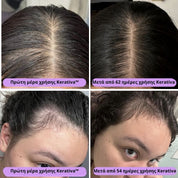 Φυσικό Έλαιο για Ανάπτυξη Μαλλιών